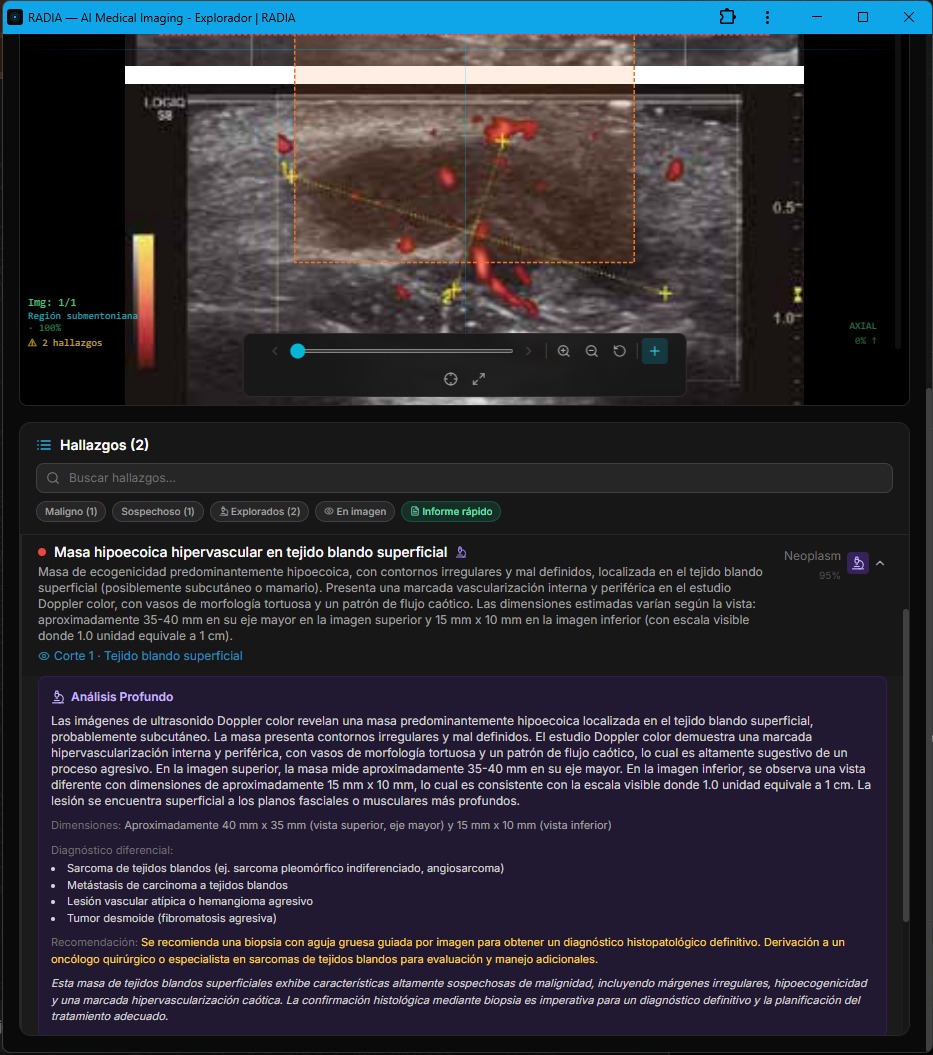 Análisis Profundo de masa hipervascular: dimensiones 35-40mm x 15x10mm en dos vistas, contornos irregulares, flujo caótico, diferencial clínico de sarcoma pleiomórfico