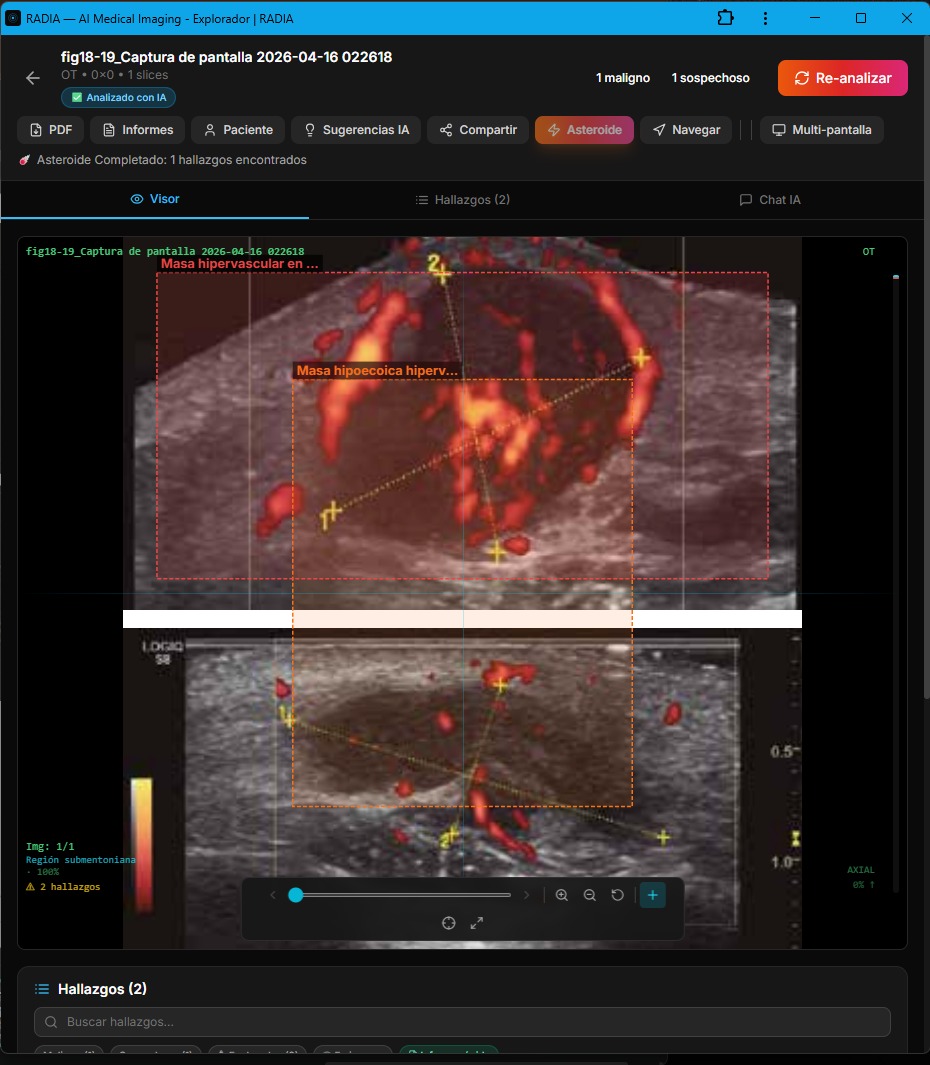 Ecografía Doppler color en RADIA: dos vistas de masa hipervascular superficial, bounding boxes etiquetados Masa hipervascular y Masa hipoecoica hiperv...