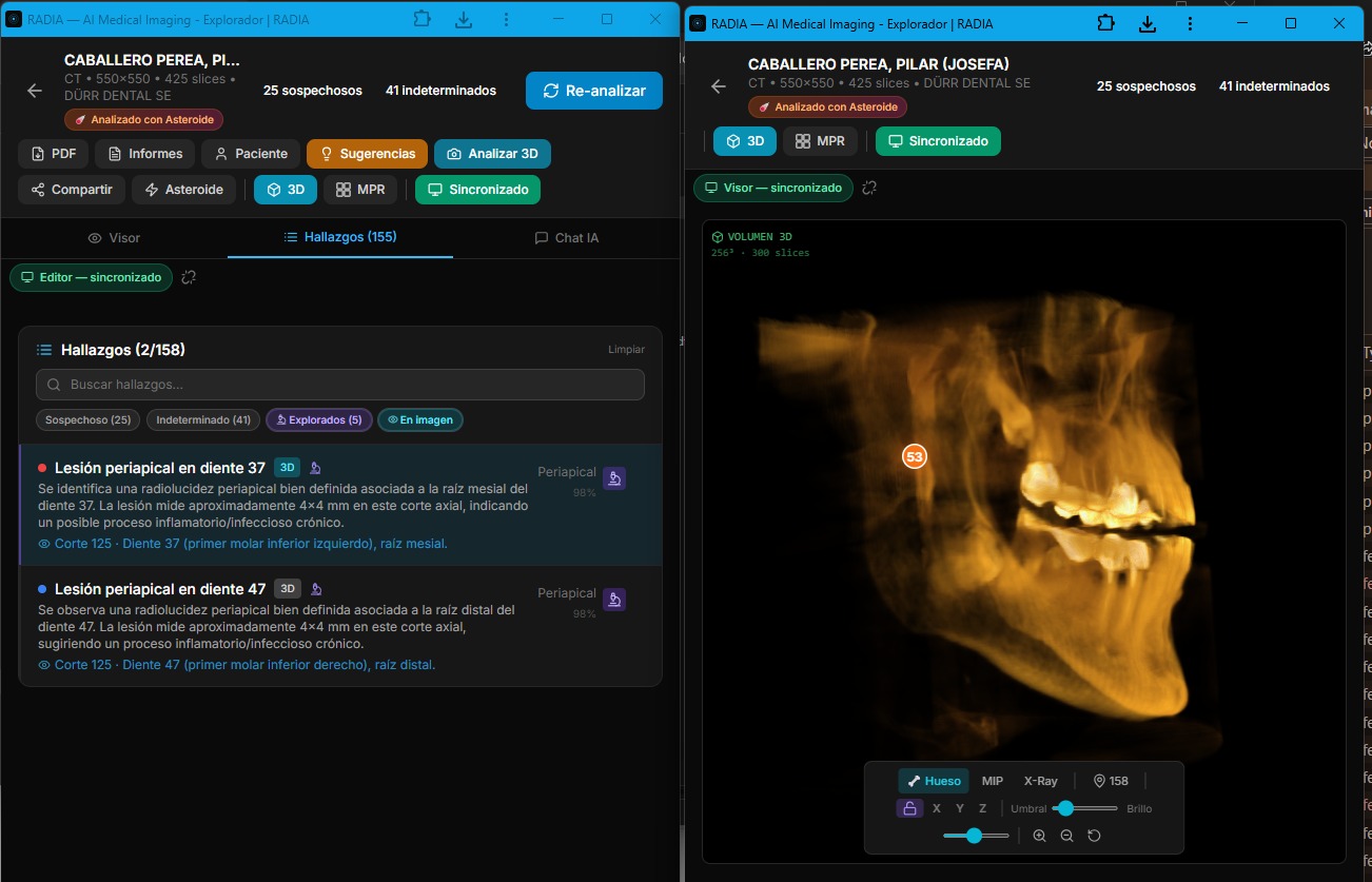 RADIA multi-monitor: editor con lista de hallazgos filtrados por severidad y botón En imagen, visor 3D volumétrico con marcadores de hallazgos