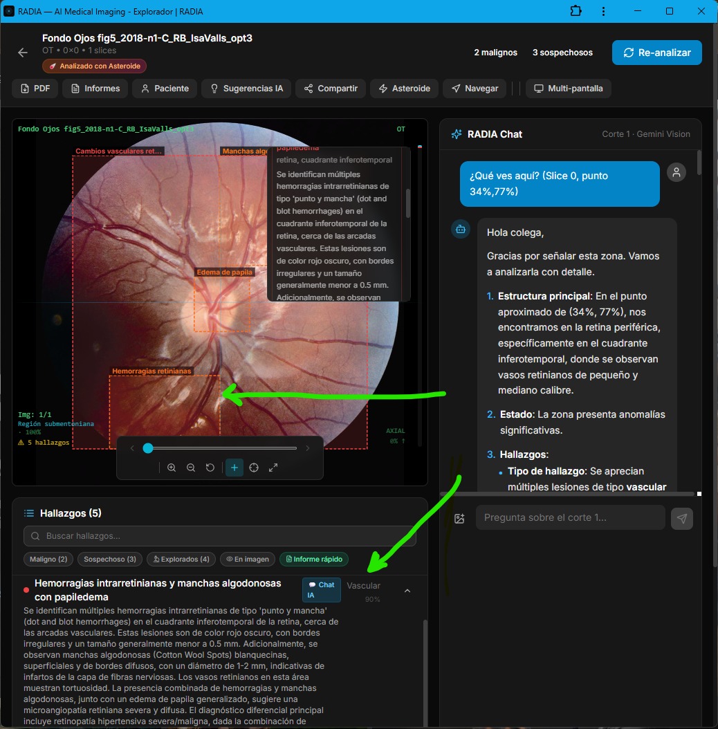 RADIA PointAsk: usuario hace click en punto (34%, 77%) de retinografía, panel de Chat IA responde con análisis estructurado de hemorragias intrarretinianas y manchas algodonosas en la zona señalada