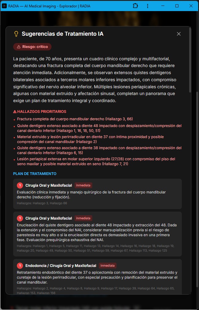 RADIA Sugerencias de Tratamiento IA: panel mostrando riesgo crítico, hallazgos prioritarios como fractura mandibular y quistes dentígeros, y plan de tratamiento escalonado con urgencia inmediata en cirugía oral y maxilofacial, endodoncia y derivaciones